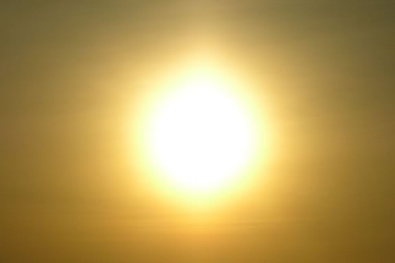 Prevention is the best bet with sunburn, but there are ways to ease the discomfort of sunburn if your get it. Prevention is the best bet with sunburn, but there are ways to ease the discomfort of sunburn if your get it.